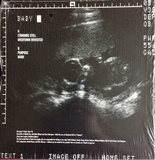 God's Acre - Baby - 4 track 10" EP